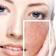 Можно ли делать маски для лица при дерматите