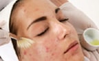 Болезни кожи лица противопоказания к бритью лица в салоне thumbnail